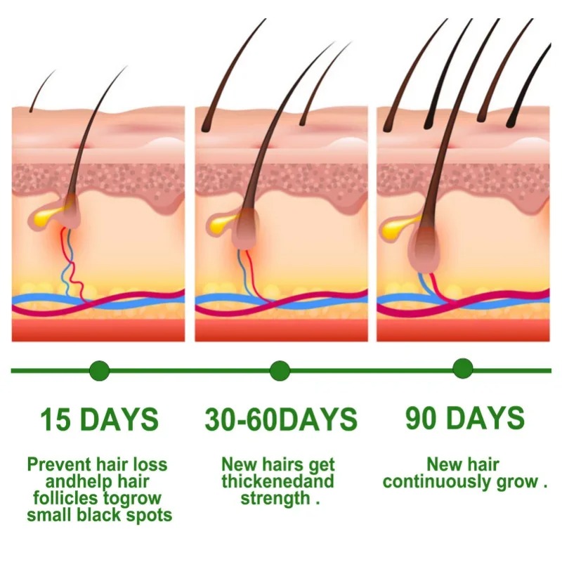 Hair Growth Serum Fast Growing - đánh giá và giá Hair Care Essence Oil
