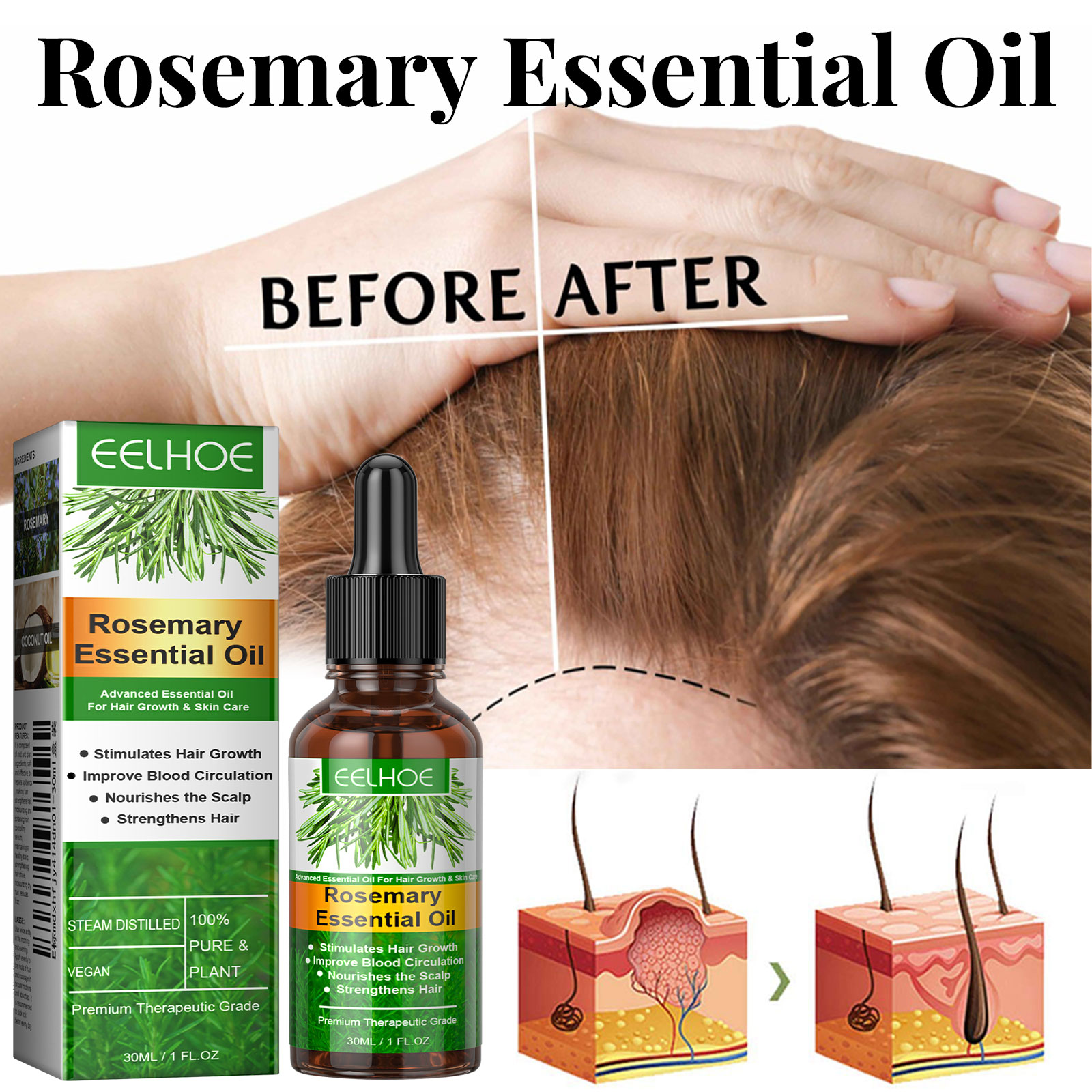 Hair Growth Serum Fast Growing - đánh giá và giá Hair Care Essence Oil