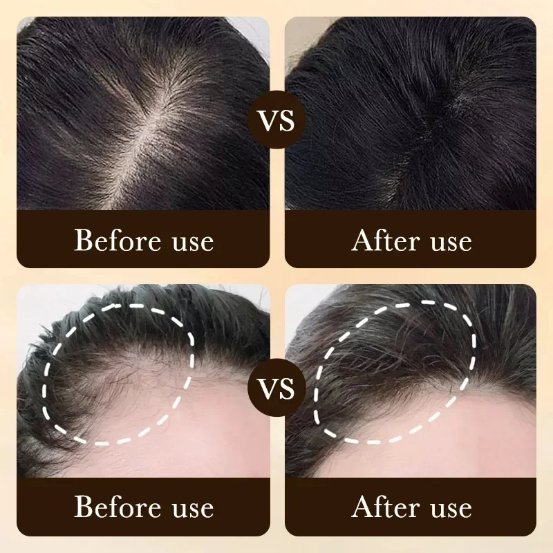 Biotin Fast Hair Growth Oil Pr - đánh giá và giá Hair Care Essence Oil